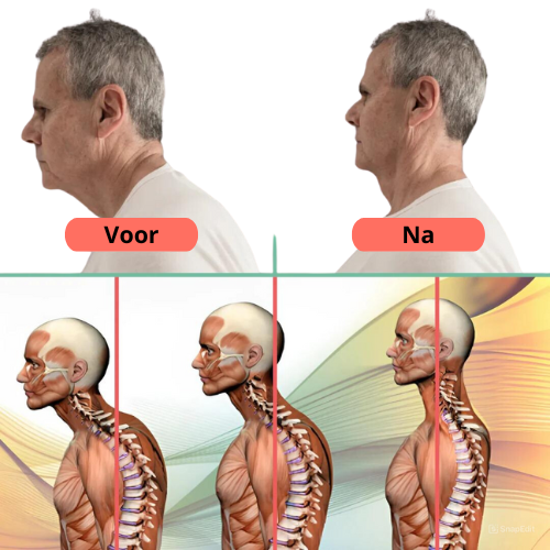 NeckZen™ Stretcher - Nekpijn Verlichten in Slechts 10 Minuten per Dag