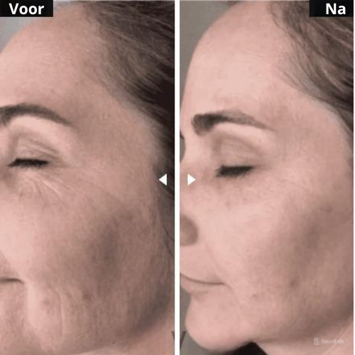 VivaLift Pro™ - Jeugdige Huid in Slechts Minuten per Dag!